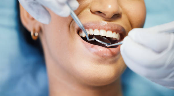 Best Emergency Wisdom Teeth Removal in Elbow Lake, MN